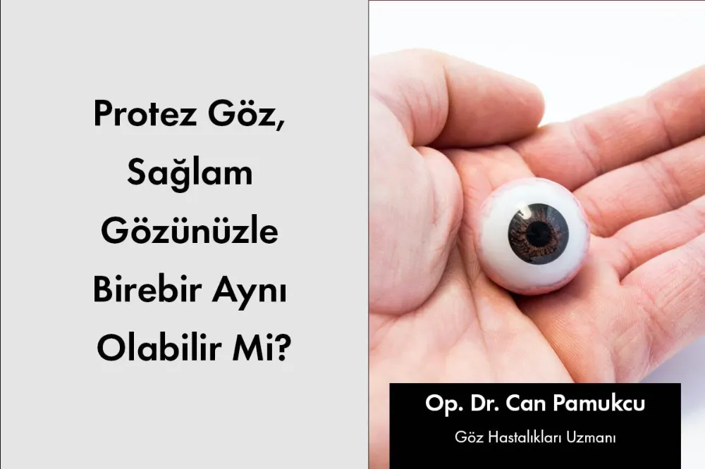 Protez Göz Sağlam Gözünüzle Birebir Aynı Olabilir Mi