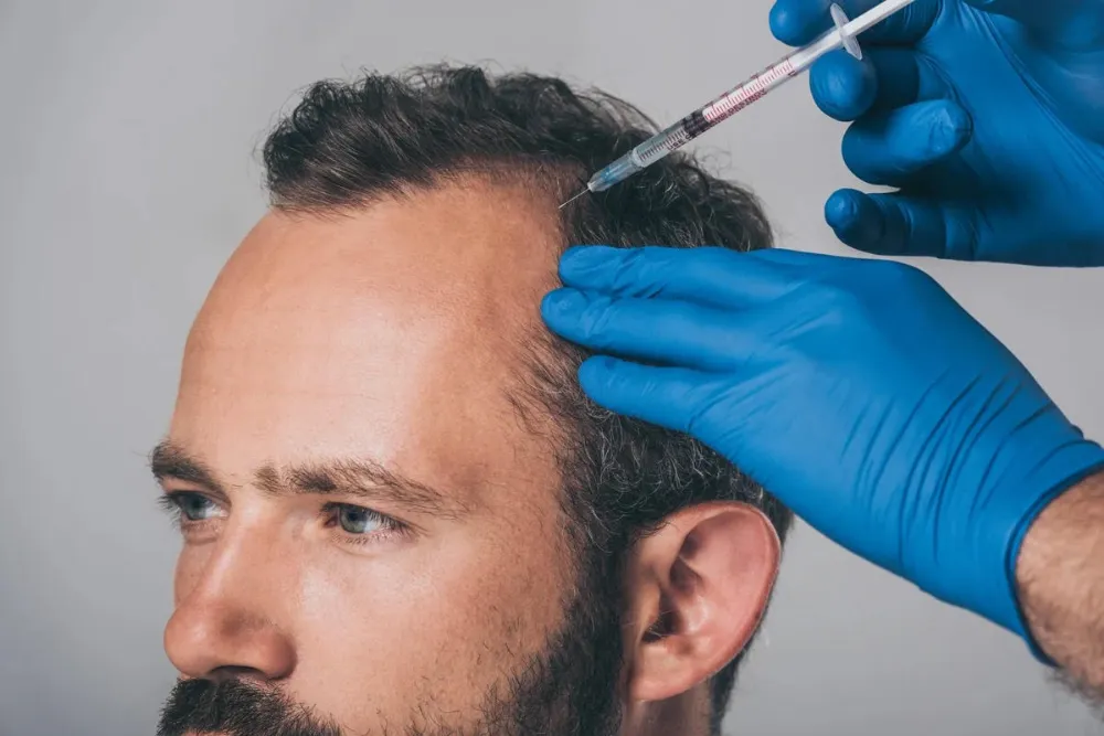 Troy Hair Istanbul Hair Transplant Package