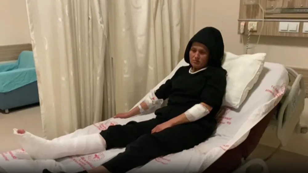 Sokakta yürüyen kadın 3 köpeğin saldırısına uğradı