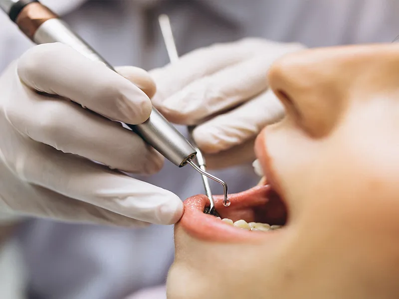 Malatya Diş Kliniği: Sağlıklı ve Estetik Gülüşler İçin Profesyonel Hizmet