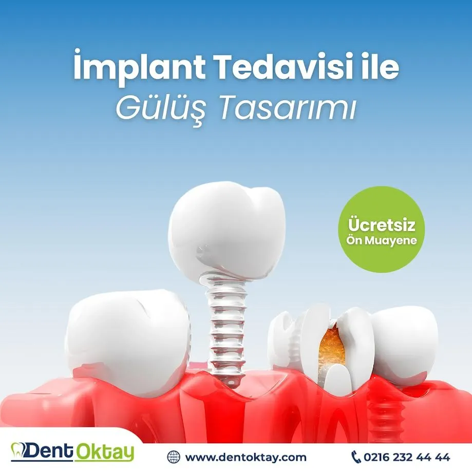 Zirkonyum ve Gülüş Tasarımında Yenilikçi Yaklaşım: DentOktay